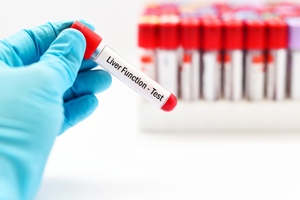 骨盆前倾怎么治疗