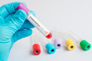 身体弱容易生病怎么办 身体弱容易生病怎么办