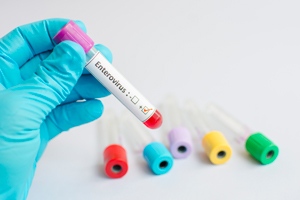 经常头疼头昏怎么回事 经常头疼头昏怎么回事