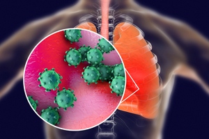 早上睡醒腰酸怎么回事