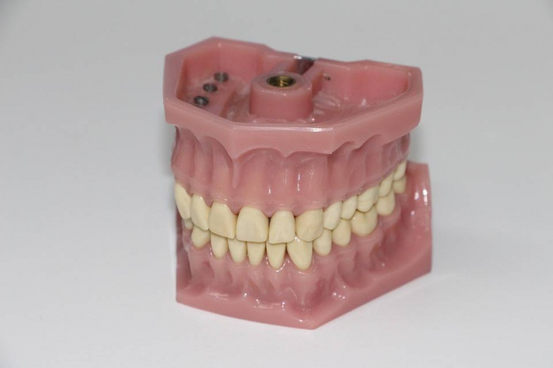 补牙对牙齿有危害吗补牙注意事项是哪些呢